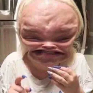 😣