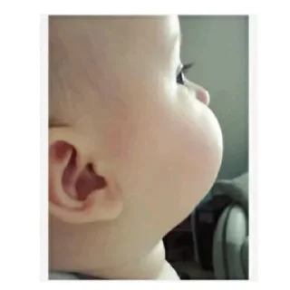 😡