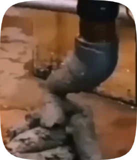 💩
