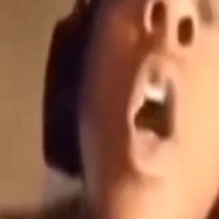 😲