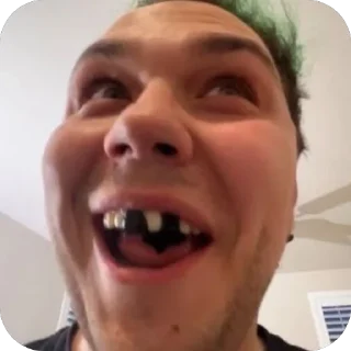 😧