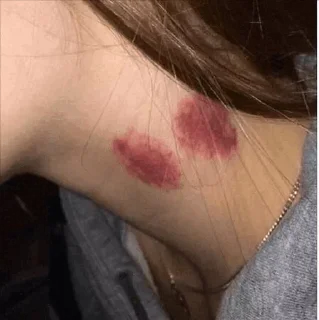 💋