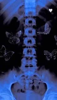 🦋