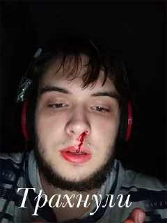 🤕