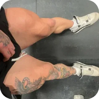 🔥