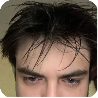 💇
