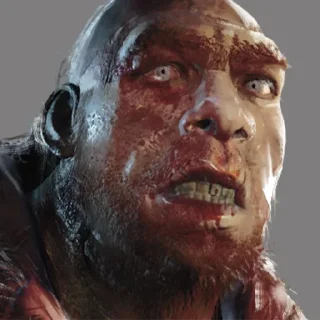 😧
