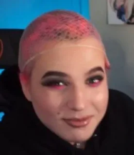 👨‍🦲