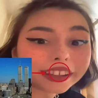 🦷