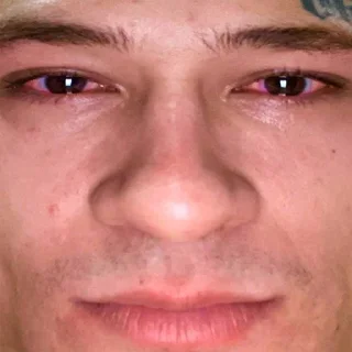 🥺