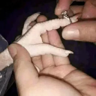 💍