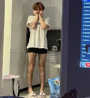 😳