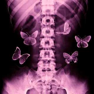 🦋