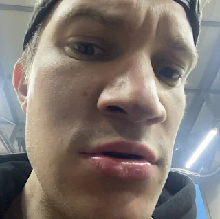 😍