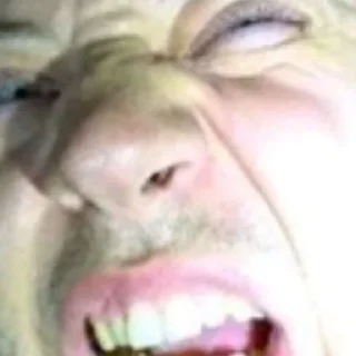 😲