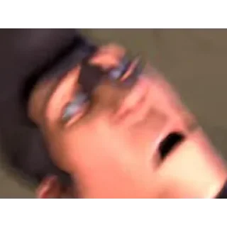 😲