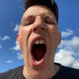 😲