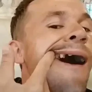 😬