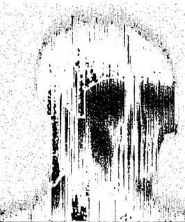 🩸