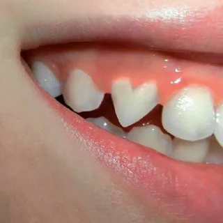 🦷