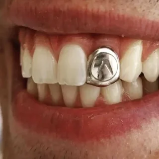 😳