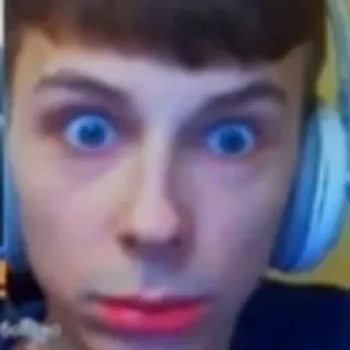 😲