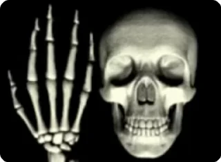 💀