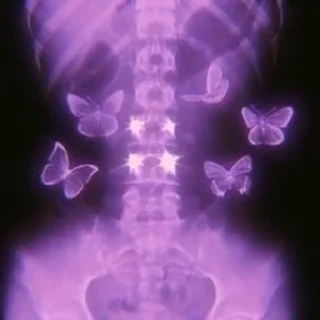 🦋