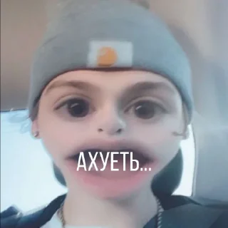 😳