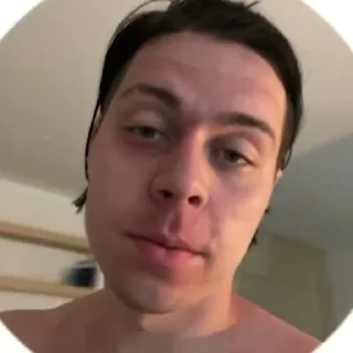 🫤