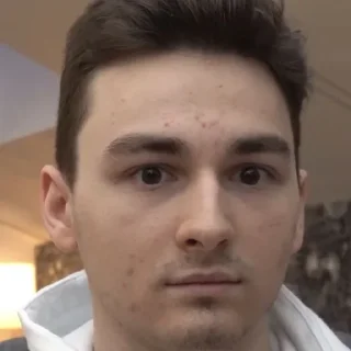 😳