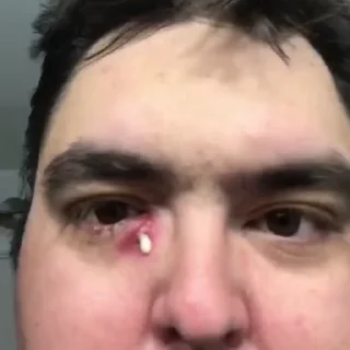 🤮