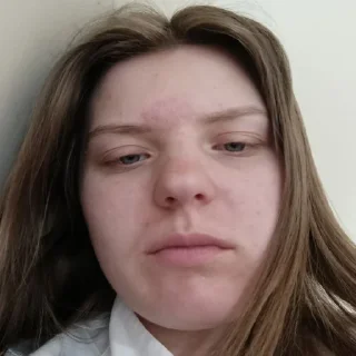 🥴
