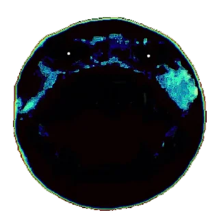 🥶
