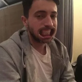 😬