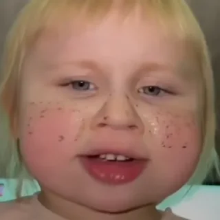 💓