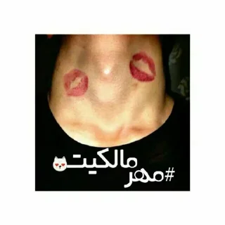 💋