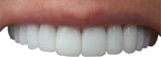 🦷