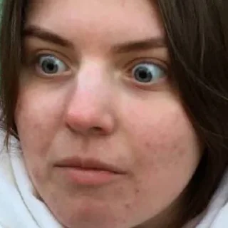 😳