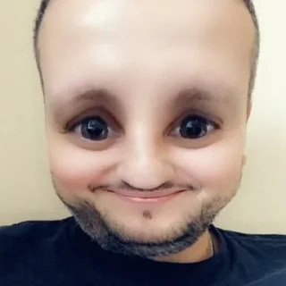 🥺
