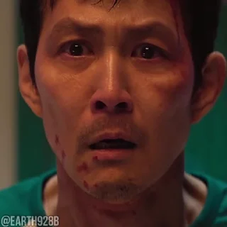 🥺