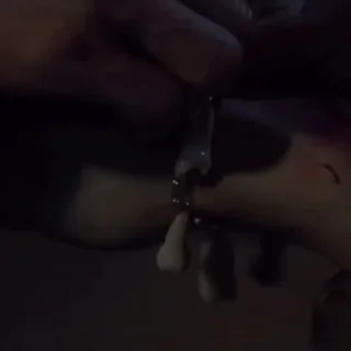 🦷