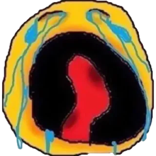 😭