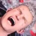 😵