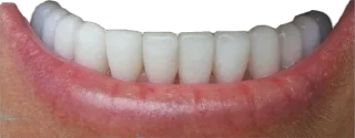 🦷