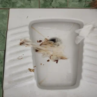 💩